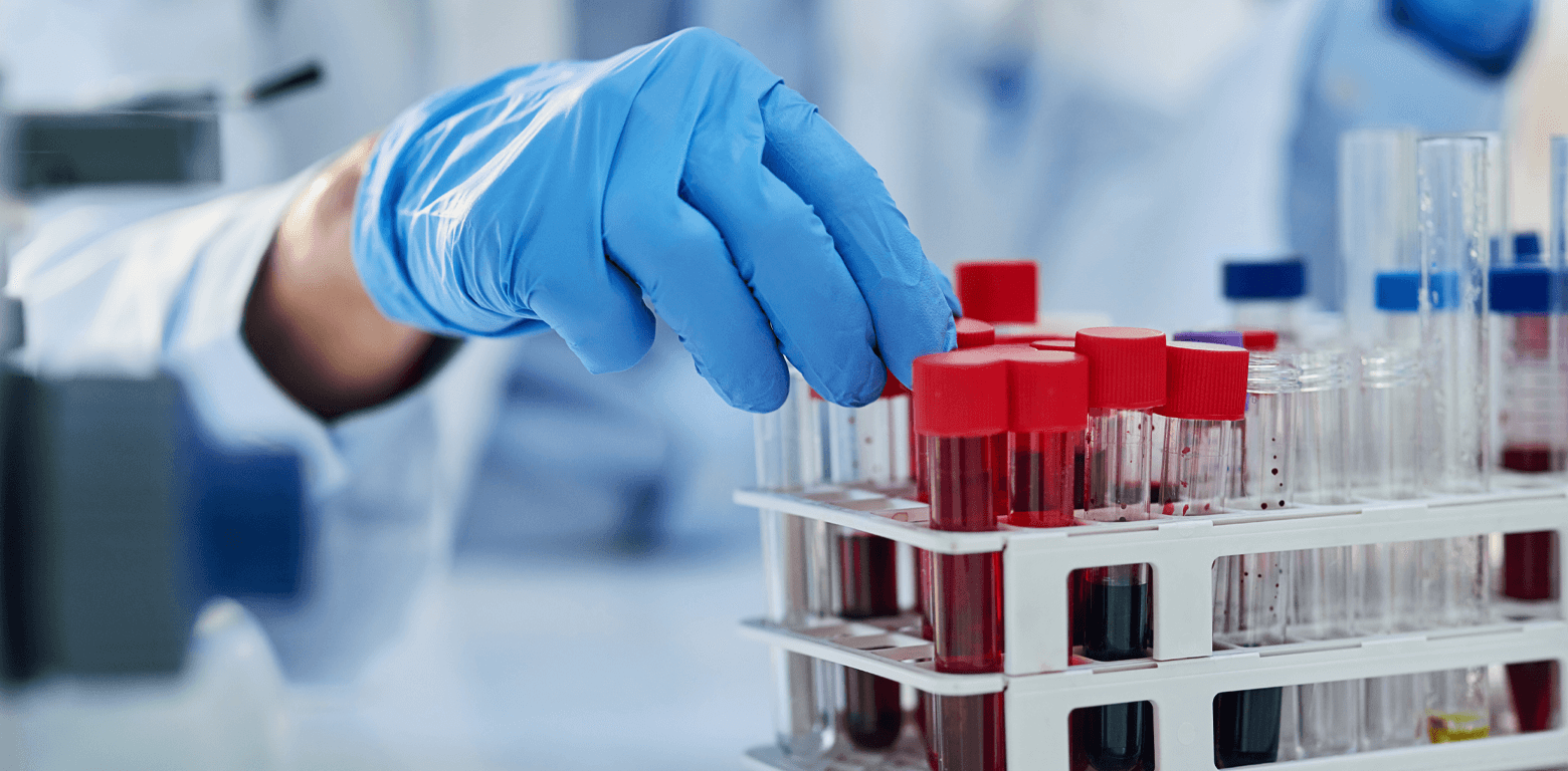 Γενική Αίματος & Βιοχημικός Έλεγχος