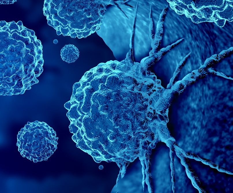 Όταν ο καρκίνος εμφανίζεται, χωρίς να γνωρίζουμε από πού ξεκίνησε