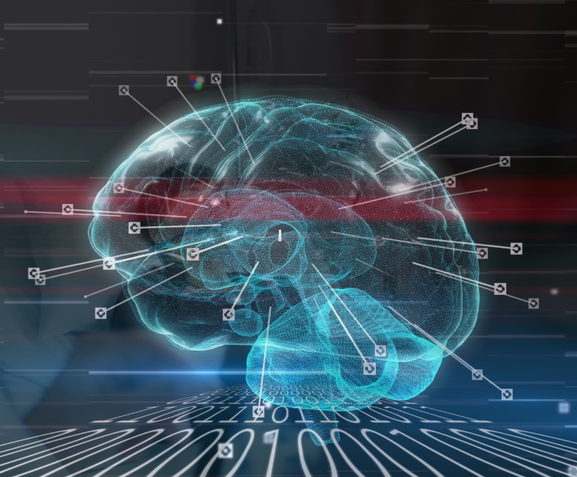 Στένωση καρωτίδων: το «σιωπηλό» αίτιο του εγκεφαλικού επεισοδίου 