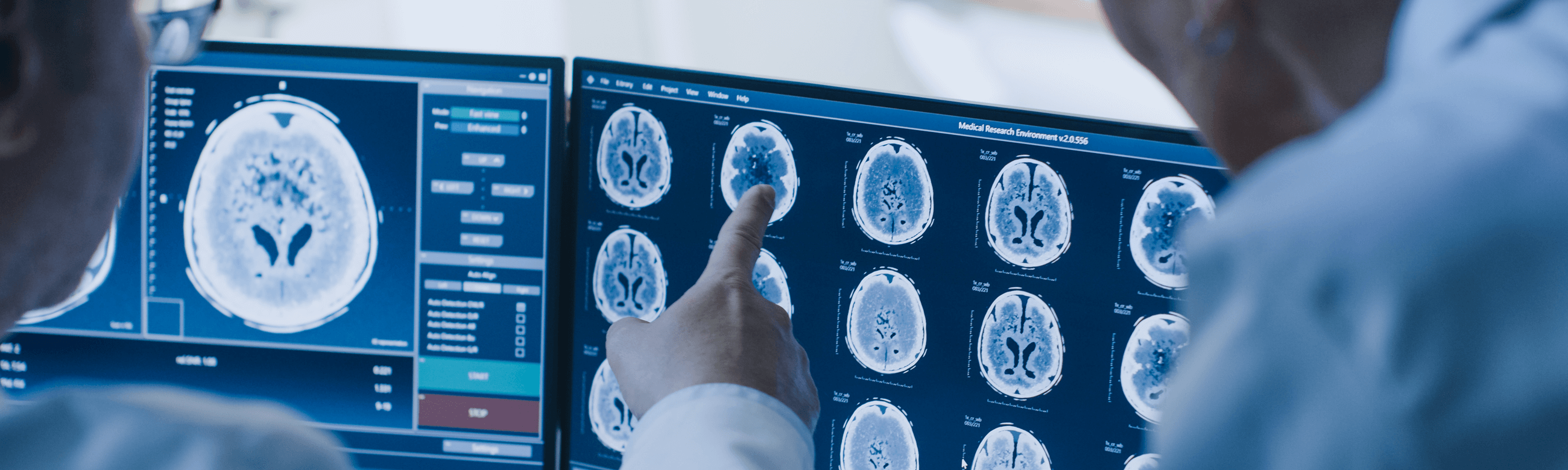 Όγκοι Εγκεφάλου