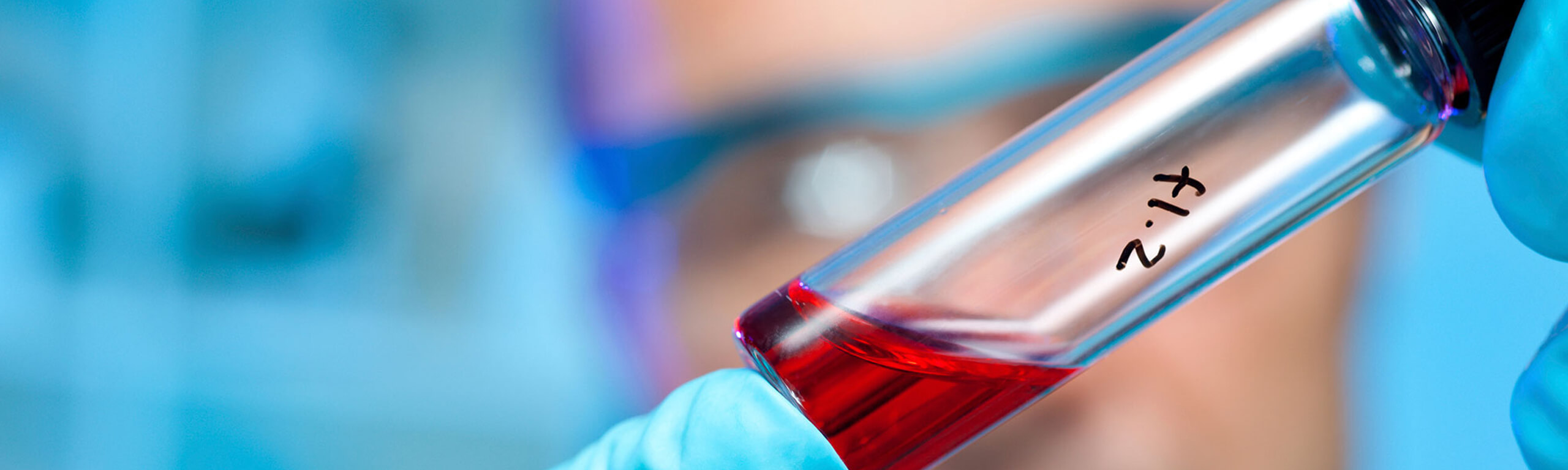 Διαγνωστικά Εργαστήρια