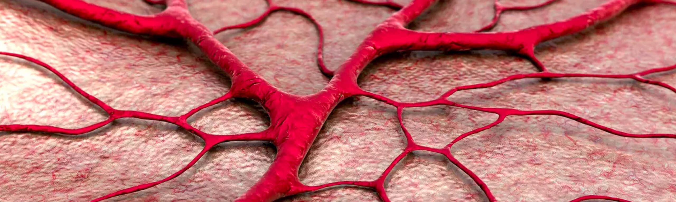 Κληρονομική Αιμορραγική Τηλεαγγειεκτασία (ΚΑΤ)