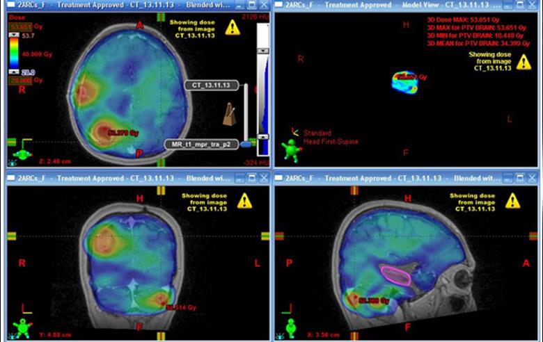 Radiation therapy under imaging guidance