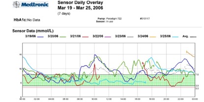 real time cgm 2