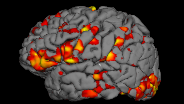 fmri1.fw 