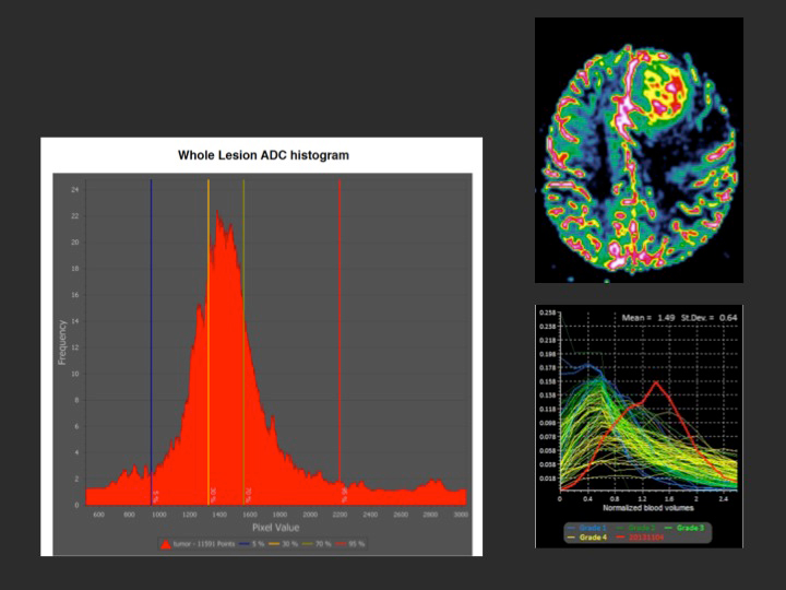 perfusion