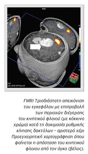 neuroogkologikh klinikh 10 web