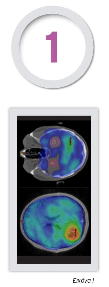 neuroogkologikh klinikh 3 web