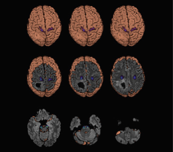 neuroogkologikh klinikh 5 web