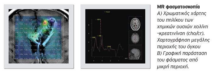 neuroogkologikh klinikh 7 web