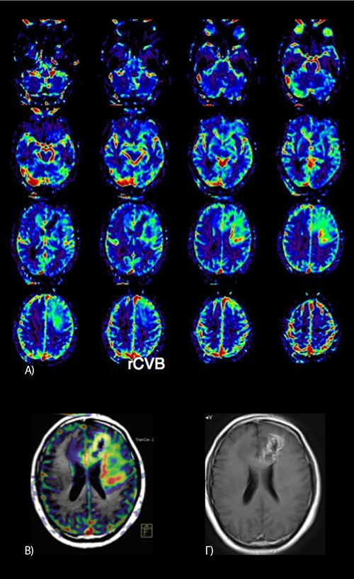 neuroogkologikh klinikh 8 web