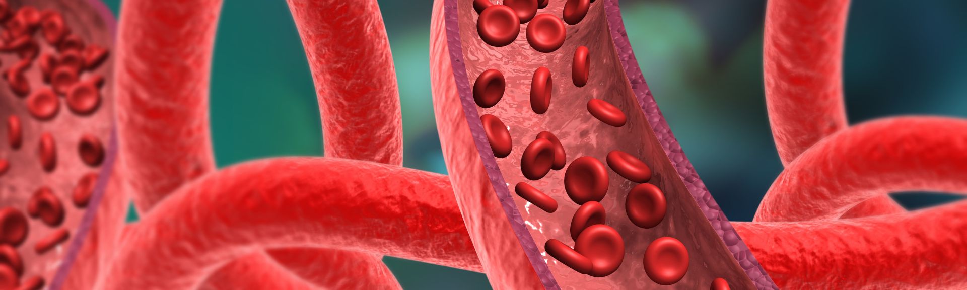 Vascular Interventions 