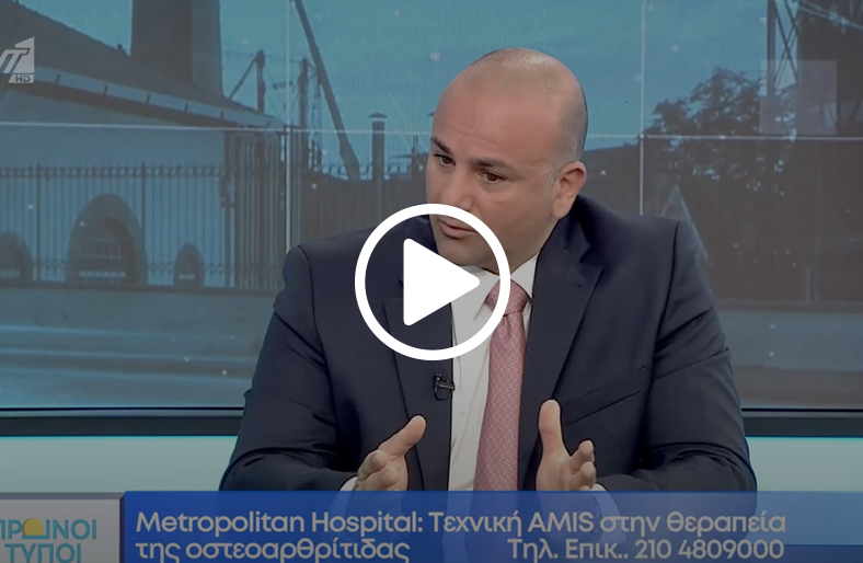 Τεχνική AMIS στη θεραπεία της οστεοαρθρίτιδας | Εμμανουήλ Μαραγκουδάκης