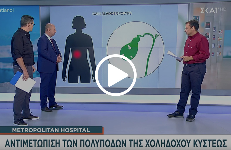 Αλέξανδρος Δαρώμ | Πολύποδες χοληδόχου κύστης