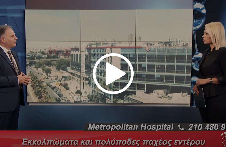 Εκκολπώματα & πολύποδες παχέος εντέρου │ Κωνσταντίνος Δελής