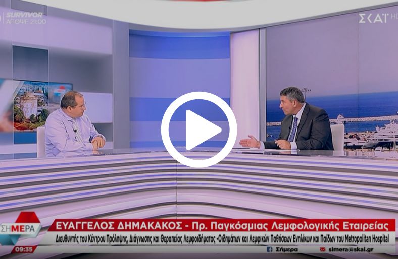  Ευάγγελος Δημακάκος│Οίδημα, πότε είναι επικίνδυνο 