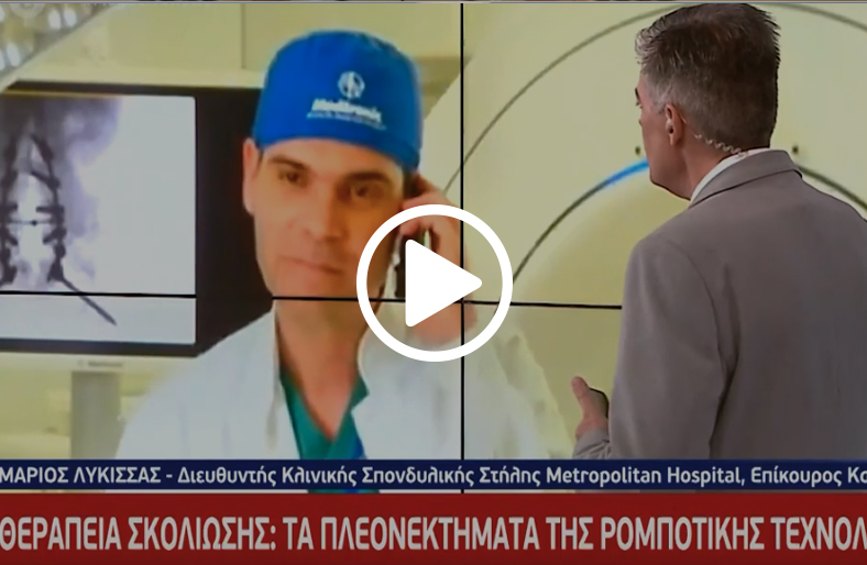 Θεραπεία σκολίωσης: τα πλεονεκτήματα της ρομποτικής τεχνολογίας│Μάριος Λυκίσσας