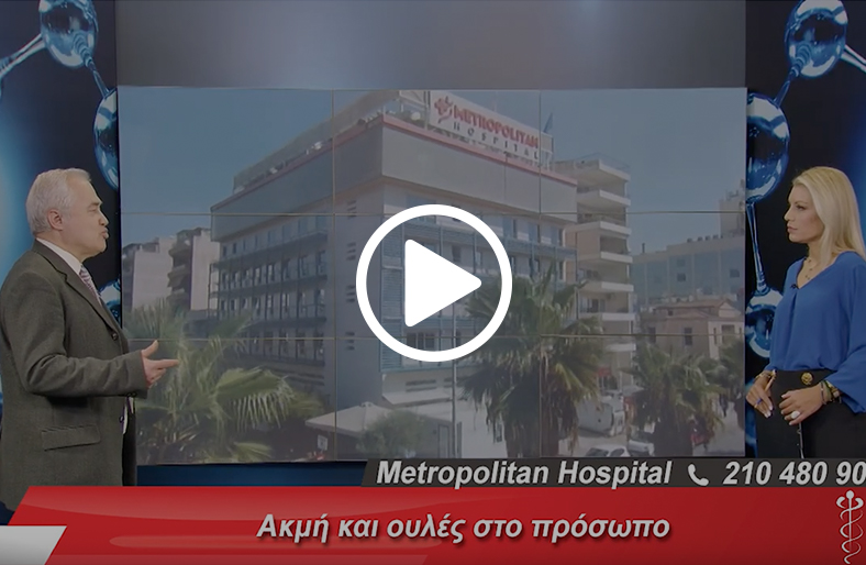 Κωνσταντίνος Μηλεούνης | Ακμή και ουλές στο πρόσωπο