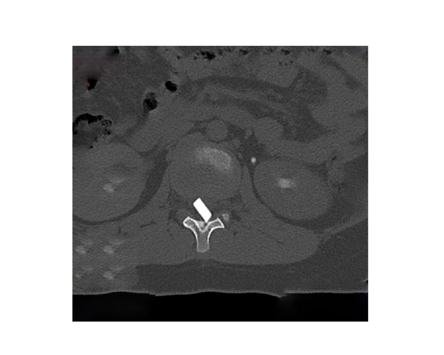 Στιγμιότυπο οθόνης 22